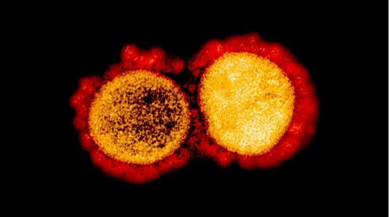Omicron успешно го избегнува имунитетот стекнат преку болест, се вели во студијата